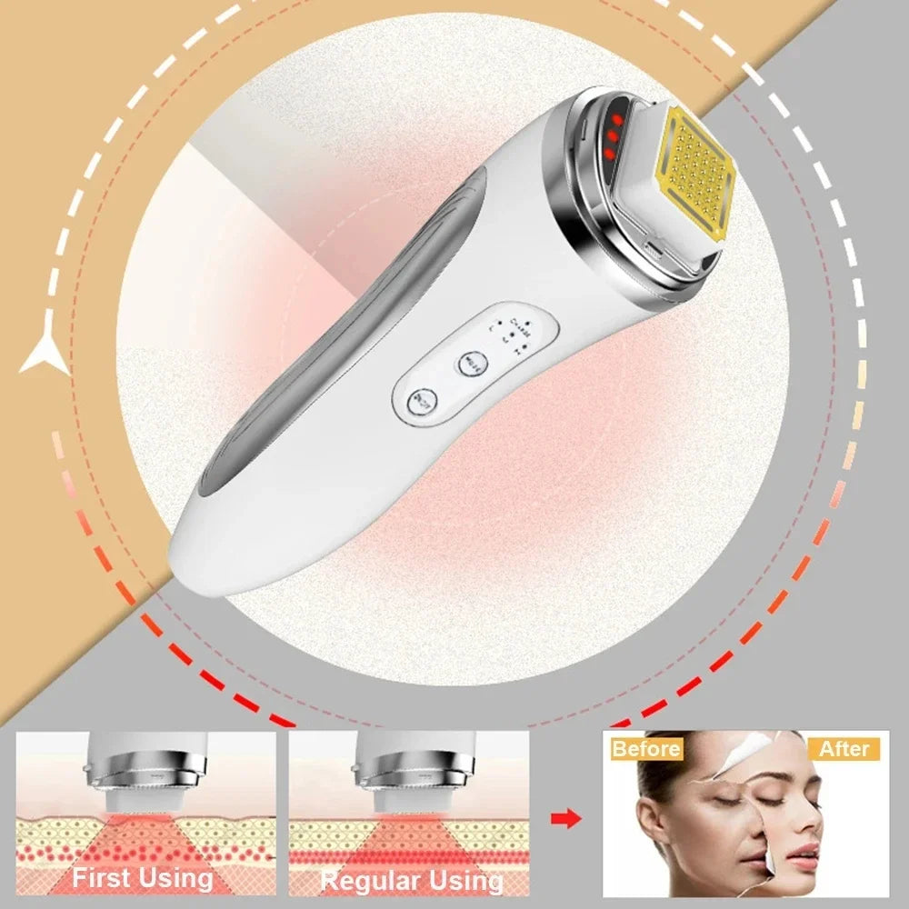 V- 0ne RF Face Lifting Device – Een Strakkere en Jeugdigere Huid Vanuit Huis